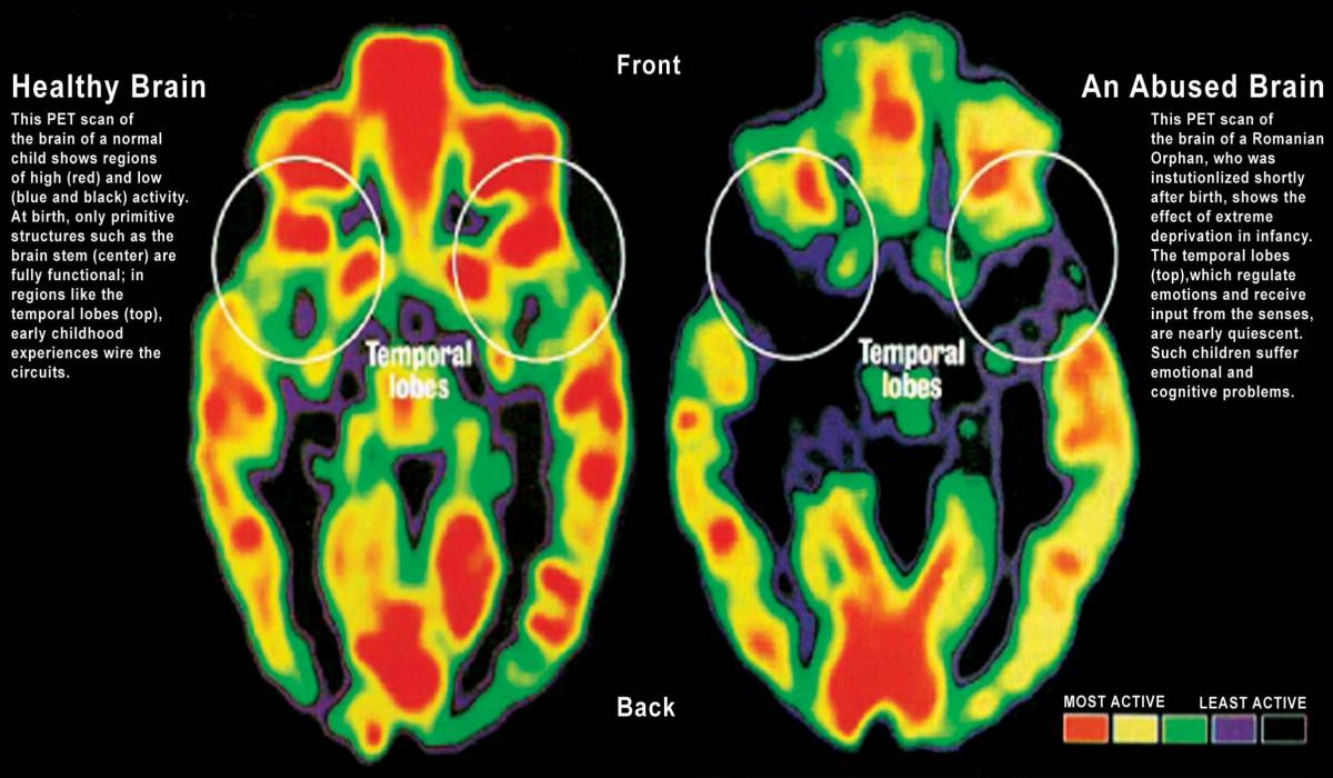 Early Attachment Relationships And Their Impact On The Brain S Wiring